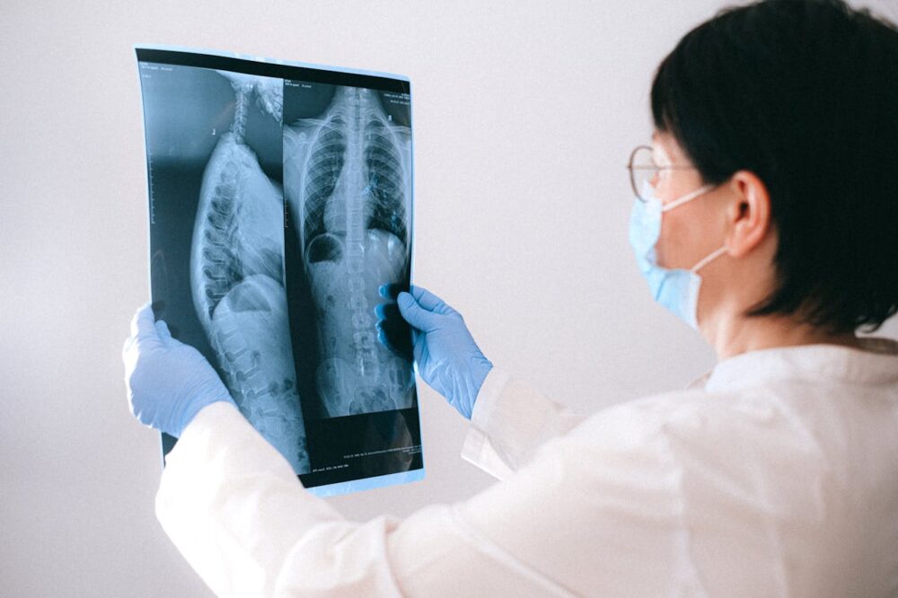Badanie RTG jest jedną z form diagnostyki schorzeń układu krążęnia