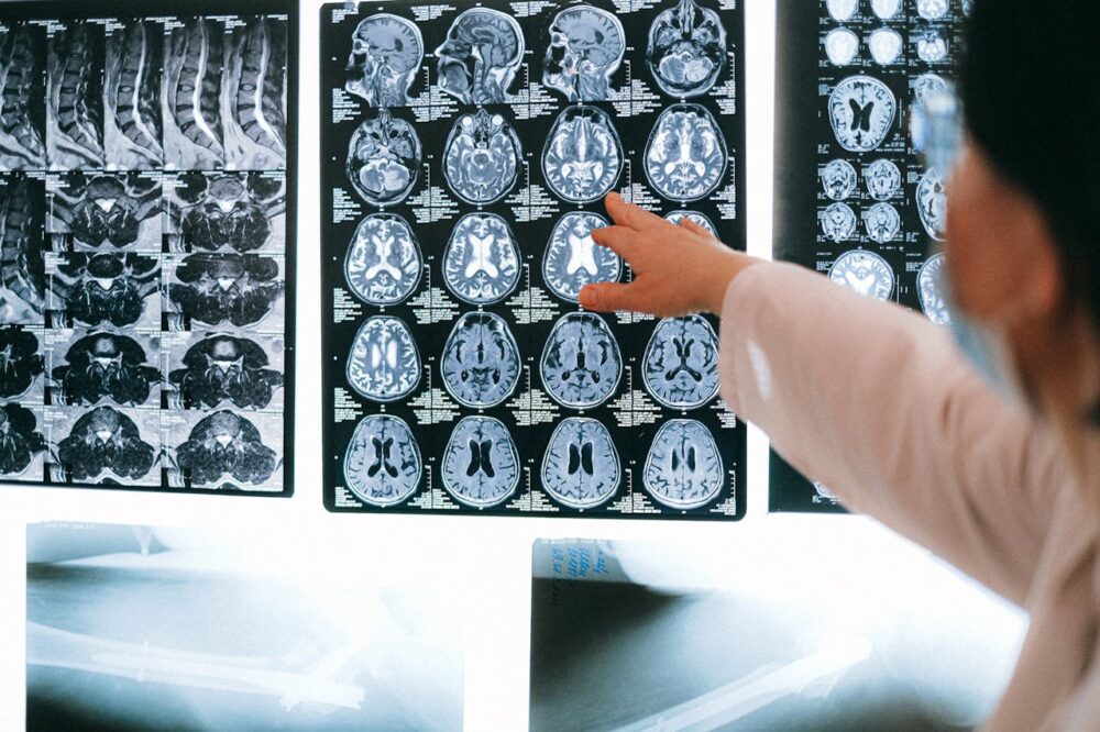 Tomografia komputerowa głowy to jedno z najważniejszych badań wykonywanych w poradniach neurologicznych
